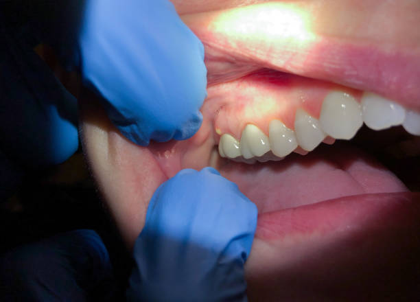 Best Urgent Dental Care for Toothaches in Tuckerton, NJ